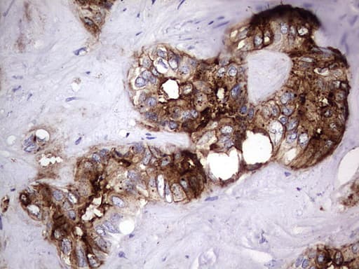 Monoclonal Mouse anti-Human CEACAM5 / CD66e Antibody (clone OTI3D8, aa35-680, IHC, WB)