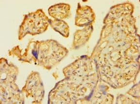 TP53 / p53 Antibody (aa2-393, FITC)