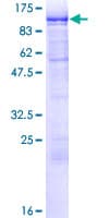 Human FACT / SSRP1 Protein (Recombinant GST)
