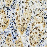ID4 Antibody (N-Terminus)