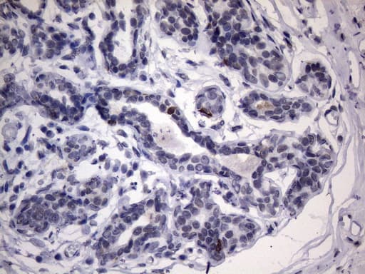 IKBKE / IKKI / IKKE Antibody (aa474-716, clone OTI5D4)