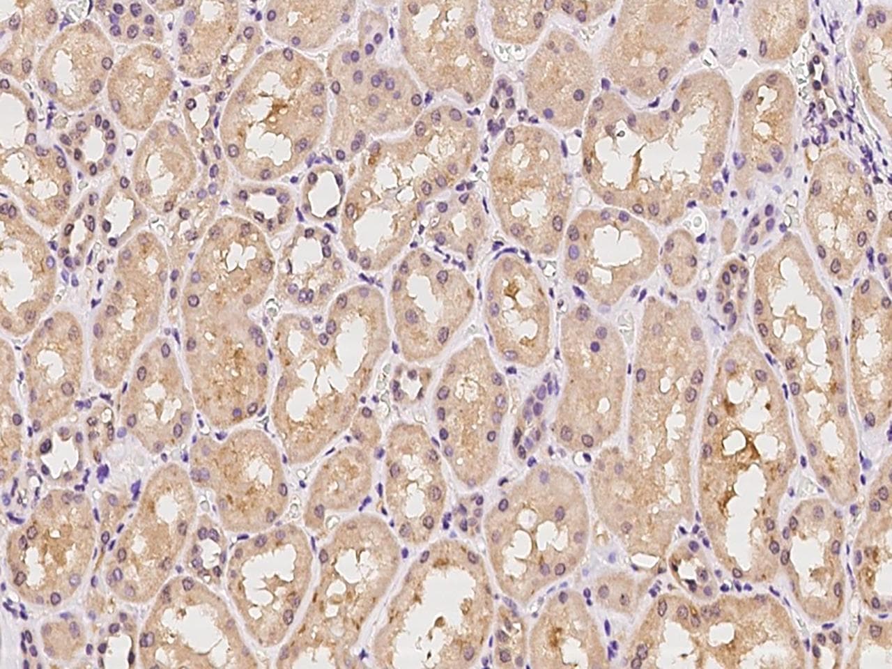 Polyclonal Rabbit anti-Human OR2C3 Antibody (IHC)
