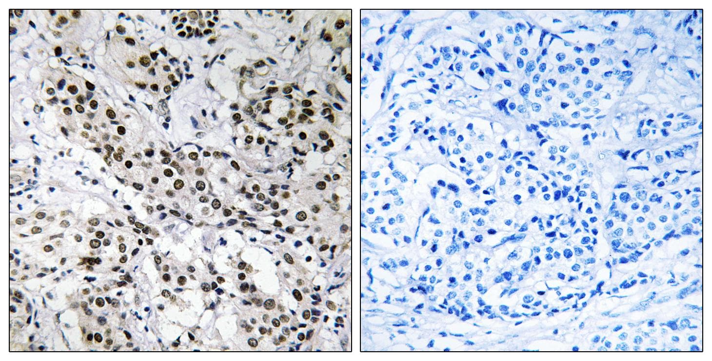 FE65L1 / APBB2 Antibody