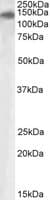 PLA2R / PLA2R1 Antibody (aa946-957)