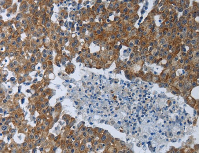 EIF2AK2 / PKR Antibody