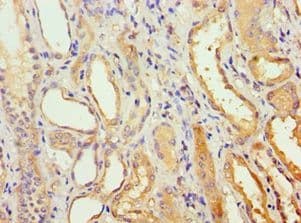 Polyclonal Rabbit anti-Human AGPAT1 Antibody (aa204-283, IHC, WB)
