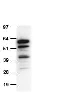 Polyclonal Chicken tdTomato Antibody (WB)