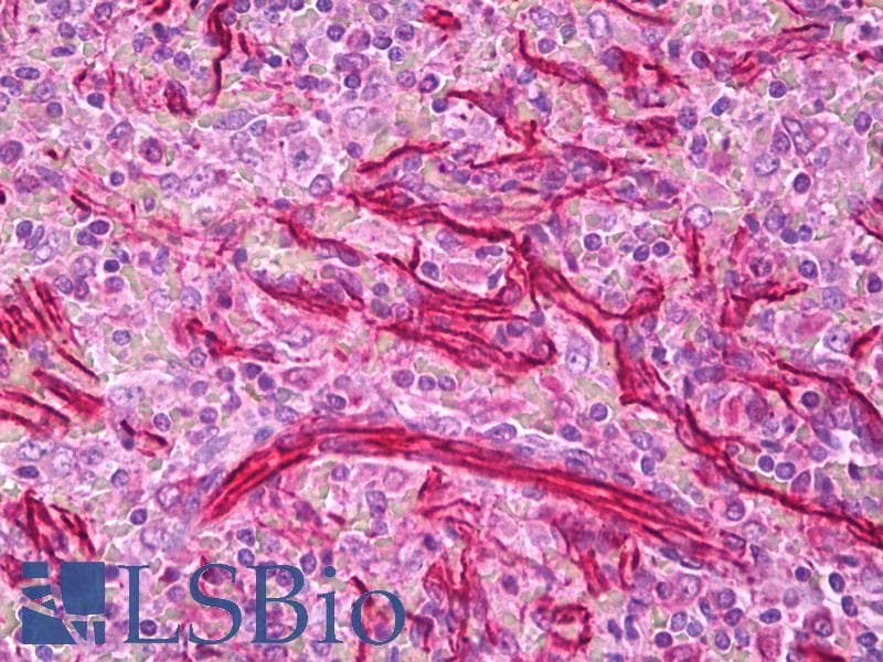 PathPlus™ Vimentin Antibody (clone 35E2)