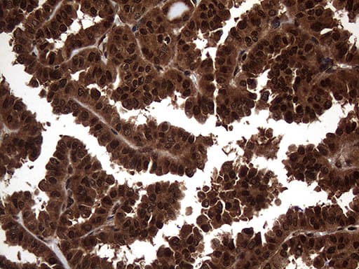 TSN / Translin Antibody (aa1-51, clone OTI1B5)