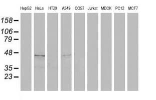 SQSTM1 Antibody (clone OTI1B2)