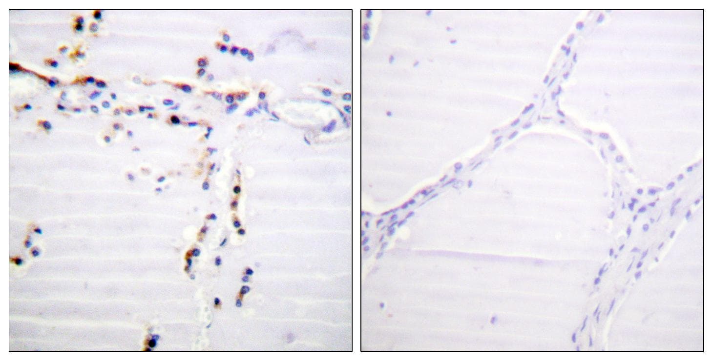 ACO1 / Aconitase Antibody (Ab-711)