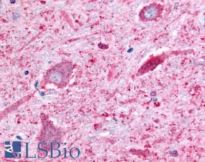 PathPlus™ Polyclonal Rabbit anti-Human ADGRB2 / BAI2 Antibody (C-Terminus, IHC)