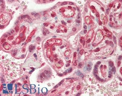 IHC-plus™ RBX1 / ROC1 Antibody (aa1-50)