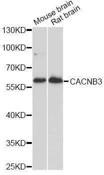 Polyclonal Rabbit anti-Human CACNB3 / Cavbeta3 Antibody (WB)
