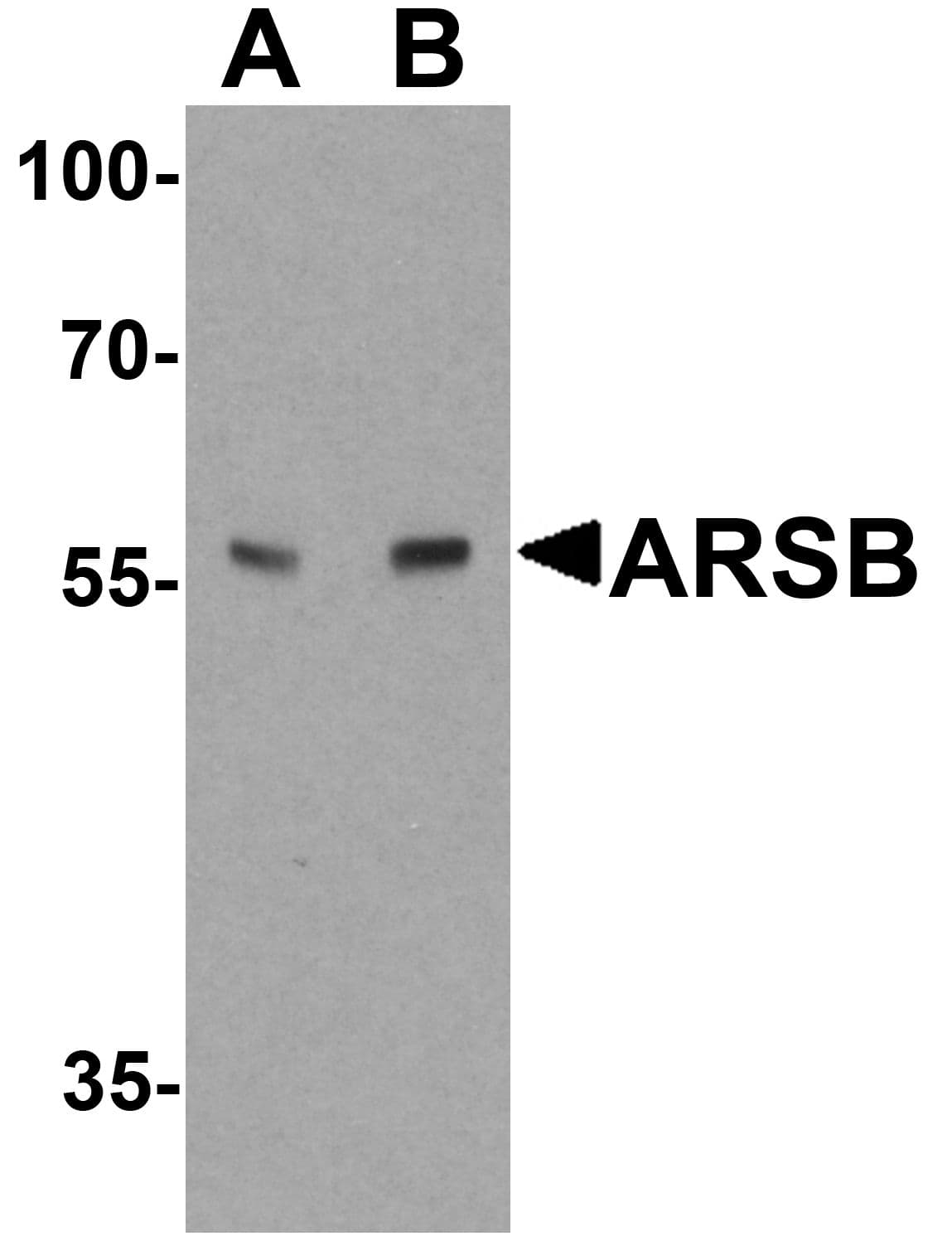 IHC-plus™ Polyclonal Rabbit anti-Human ARSB / Arylsulfatase B Antibody (IHC, IF, WB)