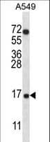COX7A2L Antibody (aa37-65)