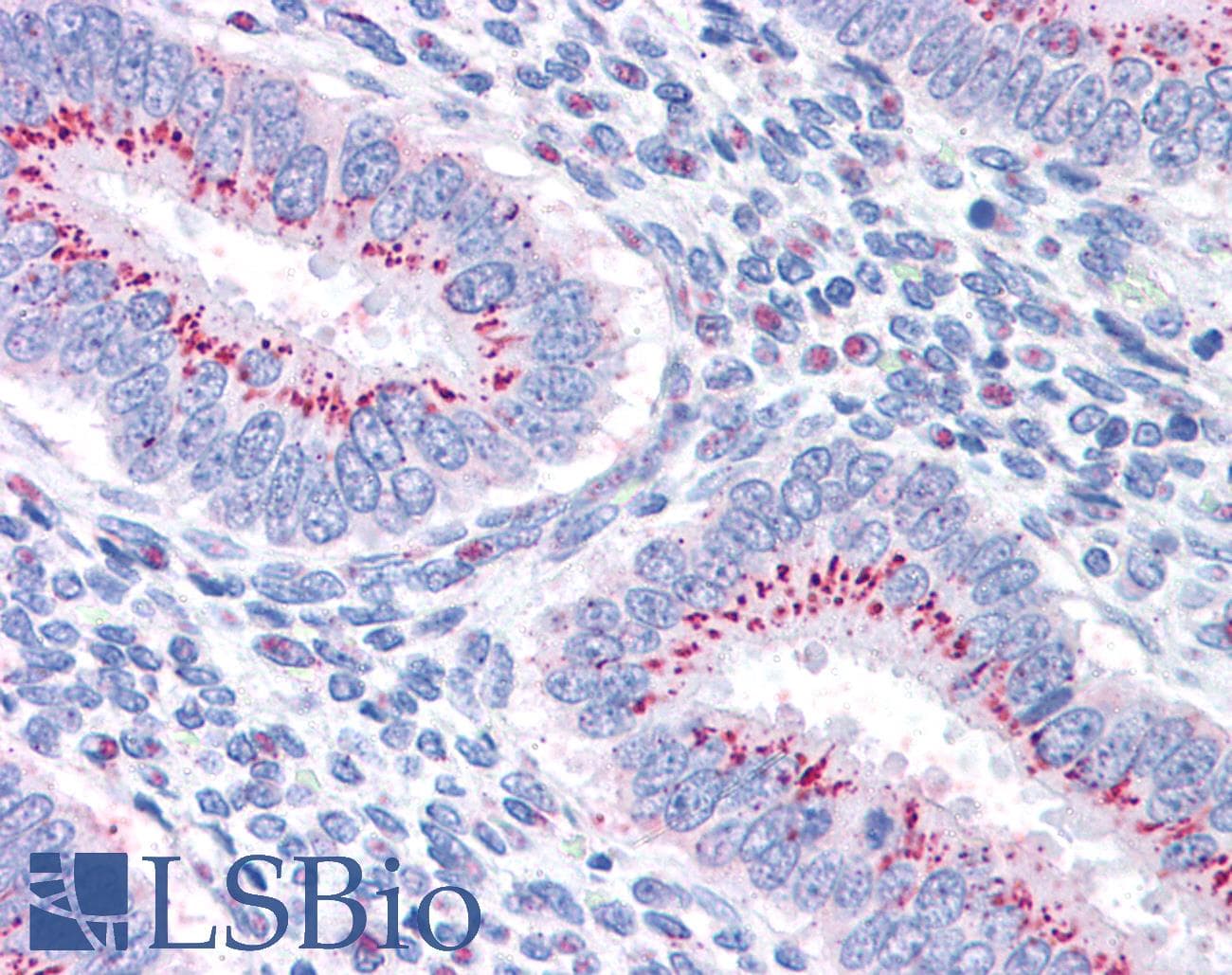 IHC-plus™ GOLM1 / GP73 / GOLPH2 Antibody (aa389-401)