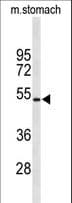 KCNJ11 / Kir6.2 Antibody (aa1-30)