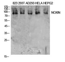 Polyclonal Rabbit anti-Human DDIAS Antibody (WB)