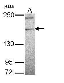 Polyclonal Rabbit anti-Human PLCH1 Antibody (aa1-329, WB)