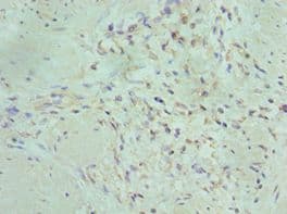 IHC-plus™ MAP2K5 / MEK5 Antibody (aa1-190)