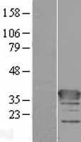 Human C1orf222 Protein (Over-Expression Lysate Myc-DDK (Flag))