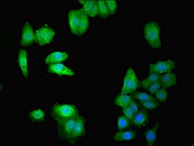 DOK1 Antibody