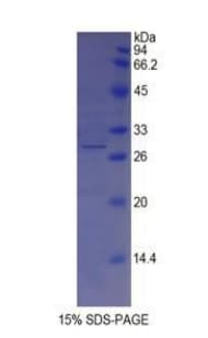 Pig Tyrosinase Protein (Recombinant His)