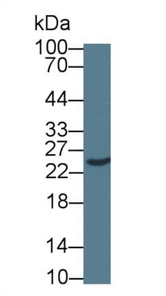 SRPRB Antibody (aa58-271, APC)