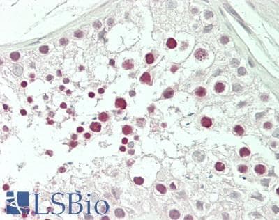 IHC-plus™ CBFA2T2 / MTGR1 Antibody
