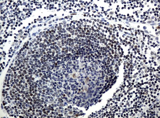 MGMT Antibody (clone UMAB52, Carrier-free)