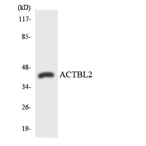 Polyclonal Rabbit anti-Human ACTBL2 Antibody (aa72-121, WB)