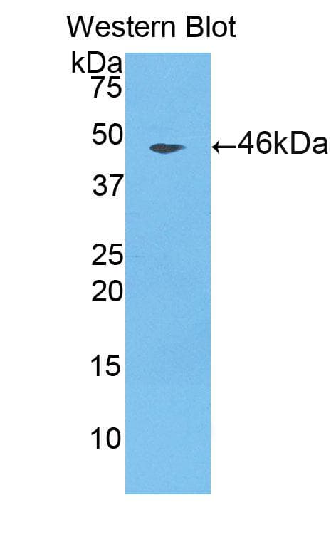 CTSL / Cathepsin L Antibody (aa115-288)