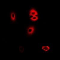 HADHA Antibody