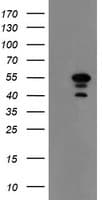 MEIS3 Antibody (aa1-261, clone OTI2F1, Carrier-free)