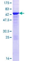 Human CA8 / Carbonic Anhydrase VIII Protein (Recombinant GST)