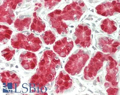 IHC-plus™ ADAMTS13 Antibody (aa75-125)