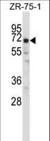 Polyclonal Rabbit anti-Human POU2F2 / OCT2 Antibody (aa10-39, IHC, WB)