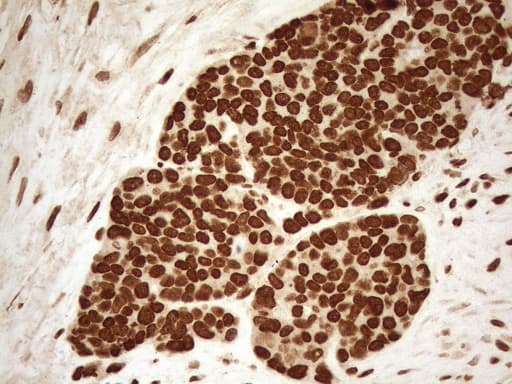 Monoclonal Mouse anti-Human ALOX5 / 5-LOX Antibody (clone OTI3F1, aa18-364, IHC, WB)