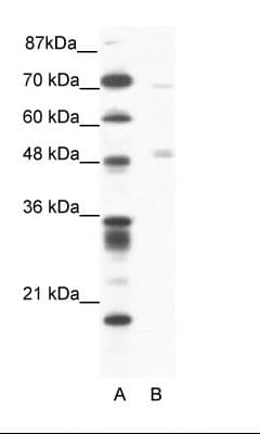 PNLIP / PL / Pancreatic Lipase Antibody (aa364-413)