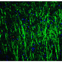IHC-plus™ Polyclonal Rabbit anti-Human DCLK3 / CLR Antibody (IHC, IF, WB)