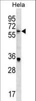 KLHL22 Antibody (aa586-614)