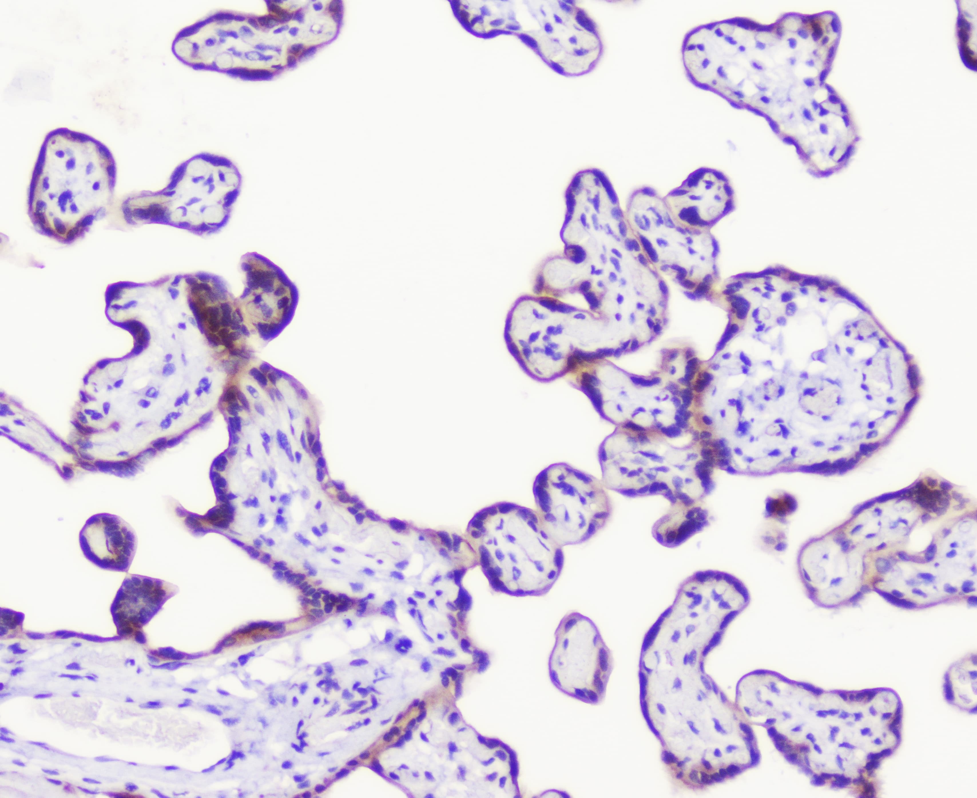 LATS1 Antibody