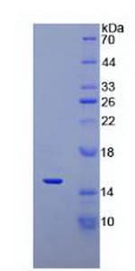 Human DEFA5 / Defensin 5 Protein (Recombinant His-S)