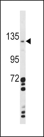 Polyclonal Rabbit anti-Human CLEC16A / KIAA0350 Antibody (aa365-391, WB)