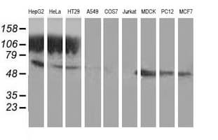 GSS / Glutathione Synthetase Antibody (clone OTI2F2)