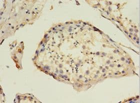 HAVCR1 / KIM-1 Antibody (aa21-290)
