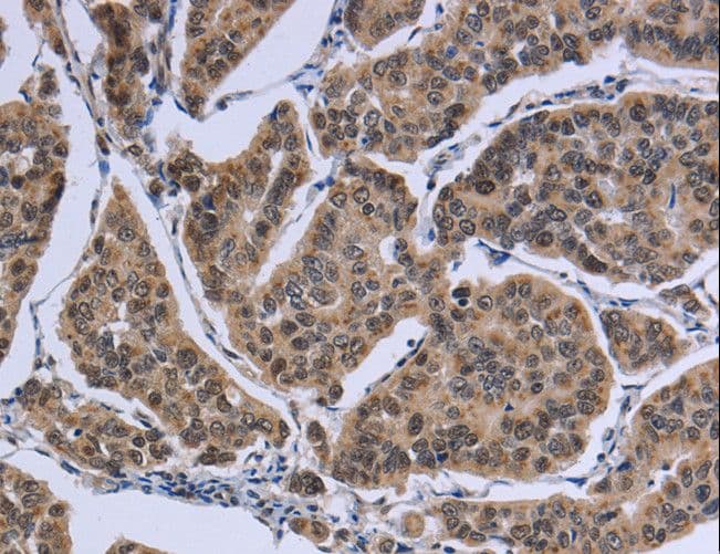 Polyclonal Rabbit anti-Human IPO8 / Importin 8 Antibody (IHC)