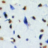 RNF2 / RING2 / RING1B Antibody