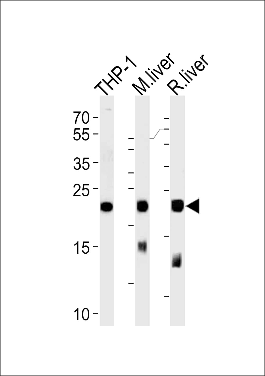 IHC-plus™ Polyclonal Rabbit anti-Human GPX1 / Glutathione Peroxidase Antibody (aa164-193, IHC, IF, WB)
